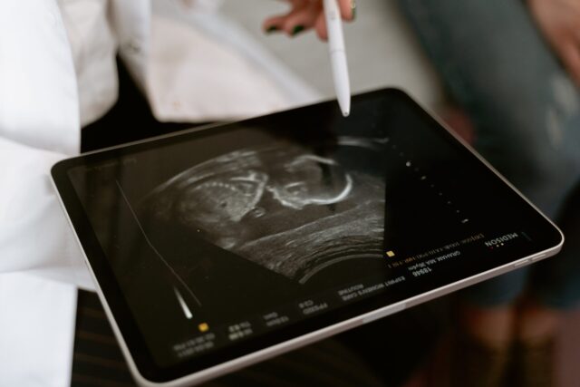 how to be a travel ultrasound tech